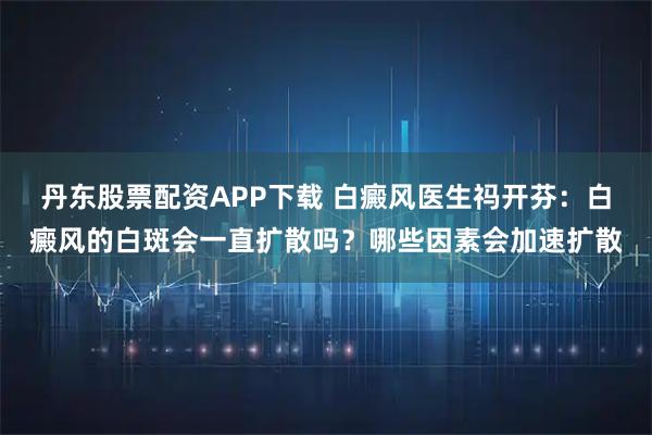 丹东股票配资APP下载 白癜风医生祃开芬：白癜风的白斑会一直扩散吗？哪些因素会加速扩散